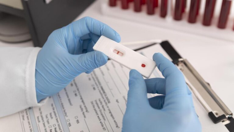 ISP alerta por venta ilegal de test rápidos de VIH y ordena retirarlos del mercado